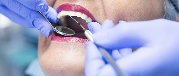 Best Emergency Root Canal Treatment in North Charleroi, PA